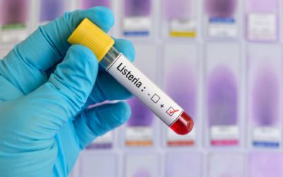 Listeria: ¿Qué es y cómo prevenirla?